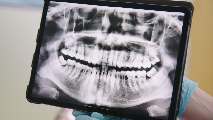 在数字平板电脑上显示牙齿x射线图像的牙医