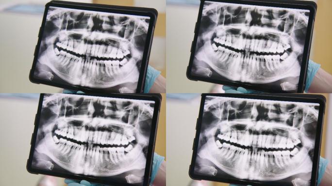 在数字平板电脑上显示牙齿x射线图像的牙医