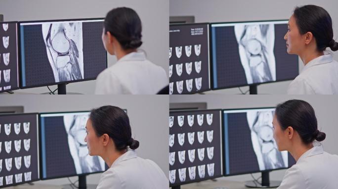 亚洲女放射学博士正在查看膝盖扫描的MRI图像