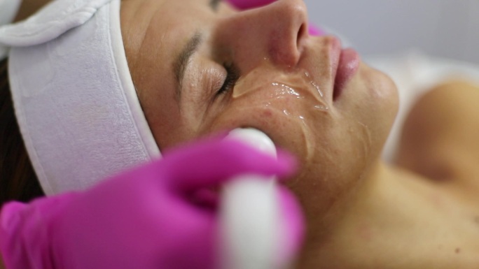 在美容院用dermapen进行面部护理。