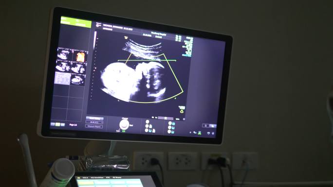 怀孕期间胎儿或婴儿身体的超声波扫描