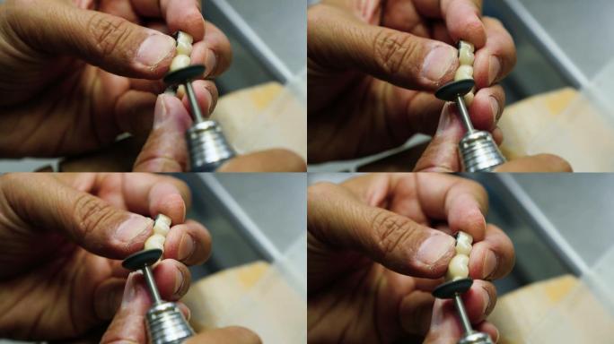 牙科技师磨牙，当牙医，在牙科诊所做牙齿。股票视频