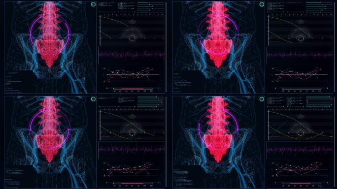 HUD与人体模型的接口。扫描虚拟患者的腰椎损伤