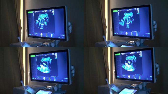 怀孕期间胎儿或婴儿身体的超声波扫描