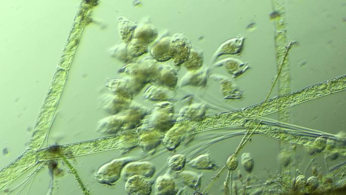 生命科学纪录片素材，显微镜下的生物钟虫1