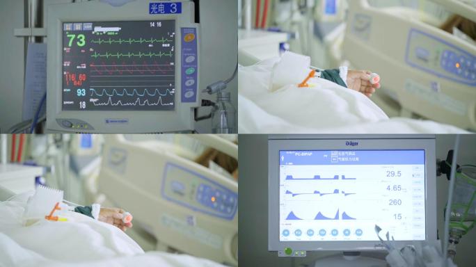 病人心电图、呼吸机屏幕数据波动变化