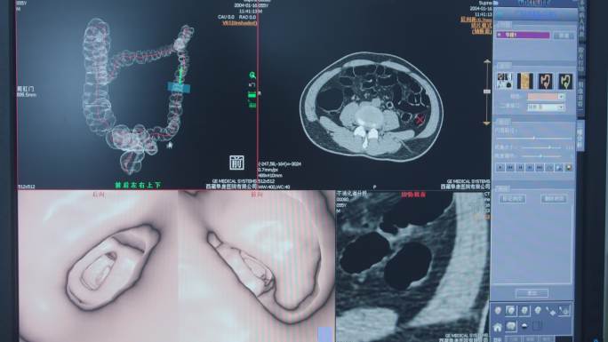 医院CT室检查实拍4K