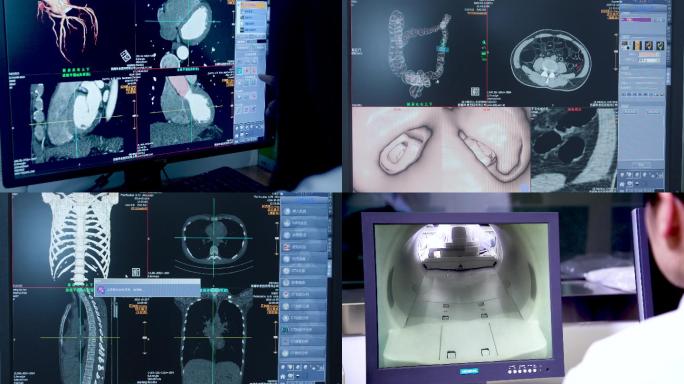 医院CT室检查实拍4K