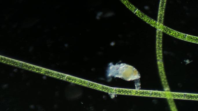 浮游生物动物素材，显微镜下的轮虫5