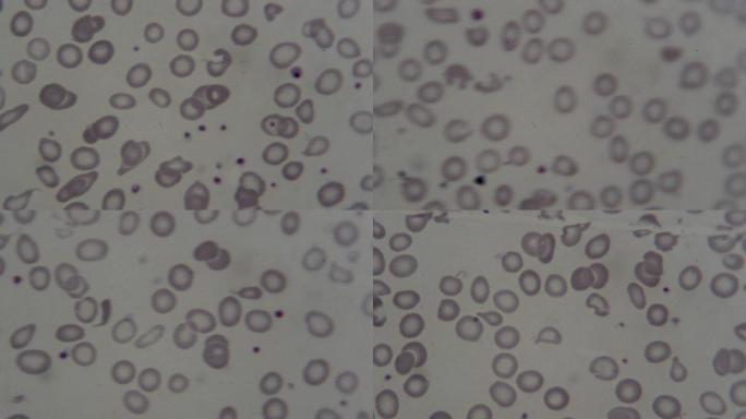 显微镜下的人血细胞