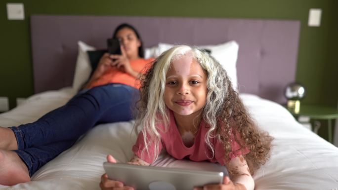 在家里使用数字平板电脑拍摄的一名患有斑疹伤寒的女孩的肖像