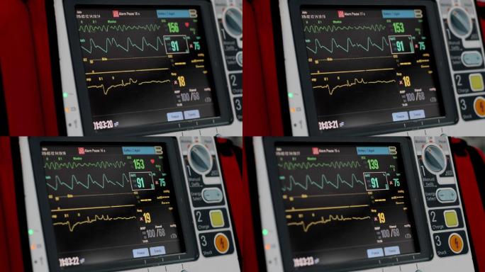 除颤器急救ICU重症监护室