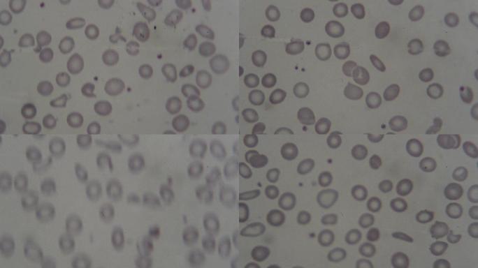 显微镜下的人血细胞