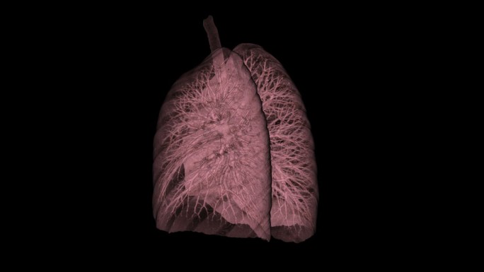 人肺的三维CT扫描图像