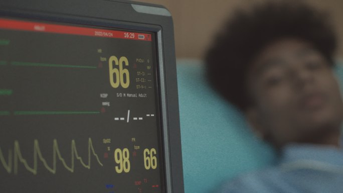 男性病房的心率监护仪和脉搏监护仪