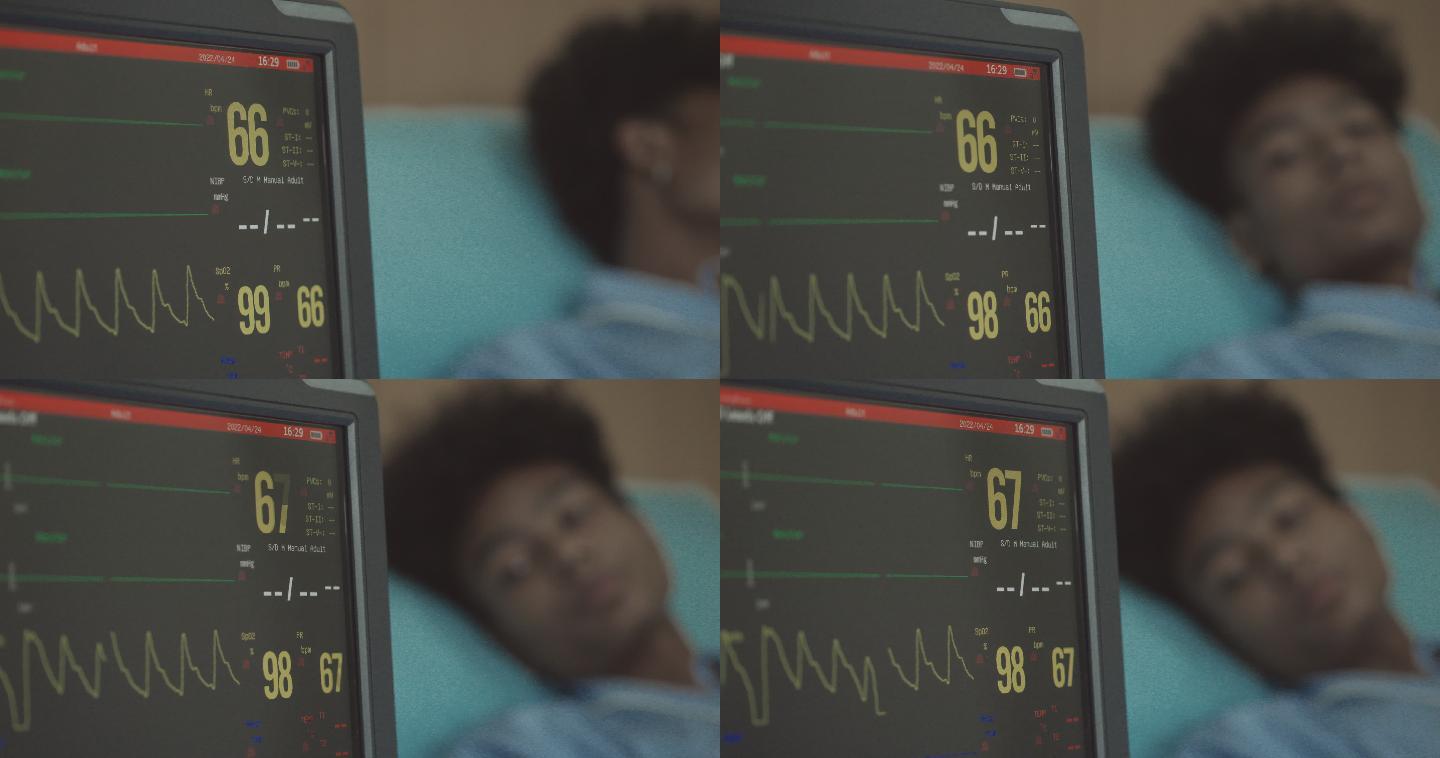 男性病房的心率监护仪和脉搏监护仪