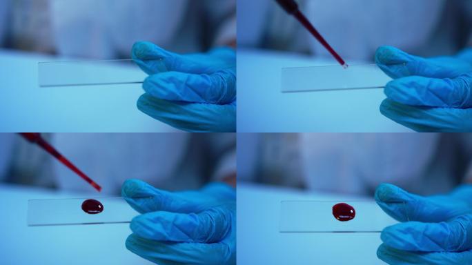 特写镜头中显微镜载玻片上的一滴血