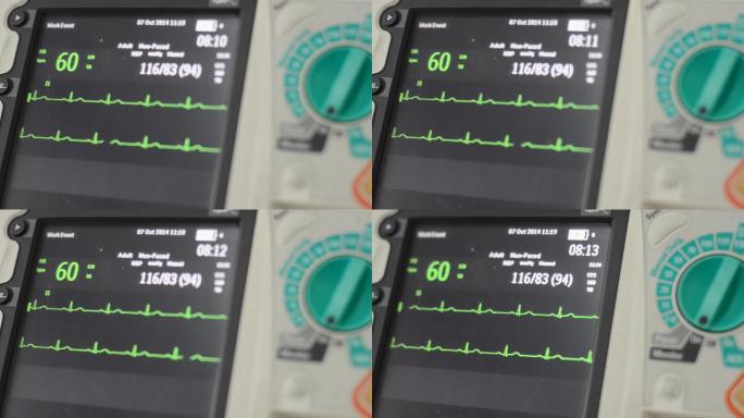 除颤器心率心率监控心率图