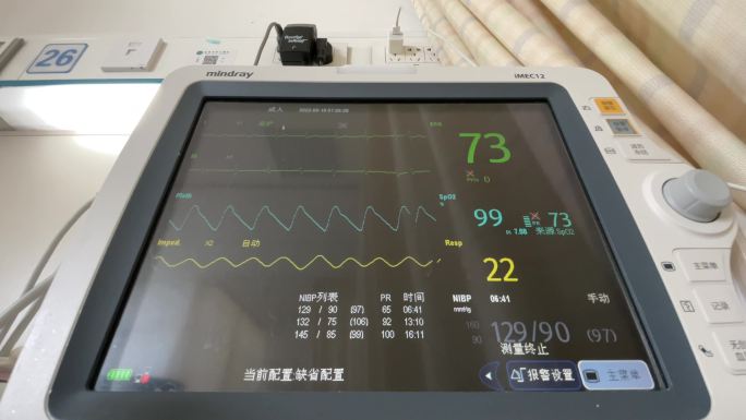 医院实拍便携式监护仪 心电图