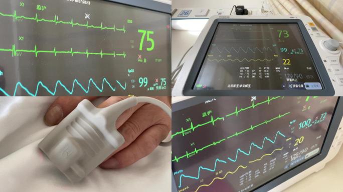 医院实拍便携式监护仪 心电图
