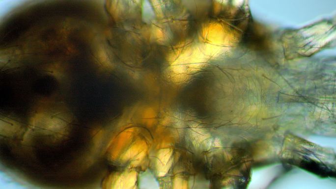 显微镜下的螨虫蠕动生物研究