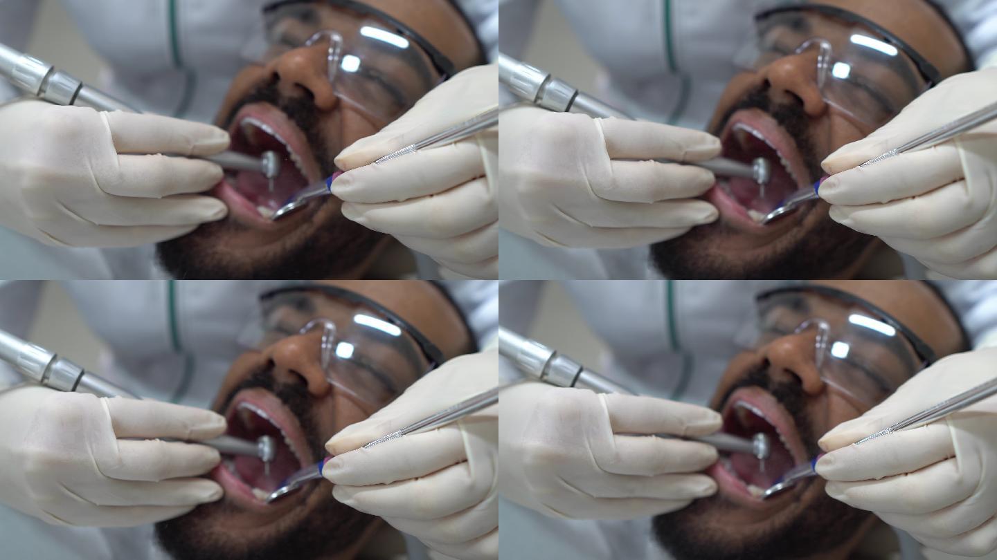牙医给病人补牙疼痛治疗诊断