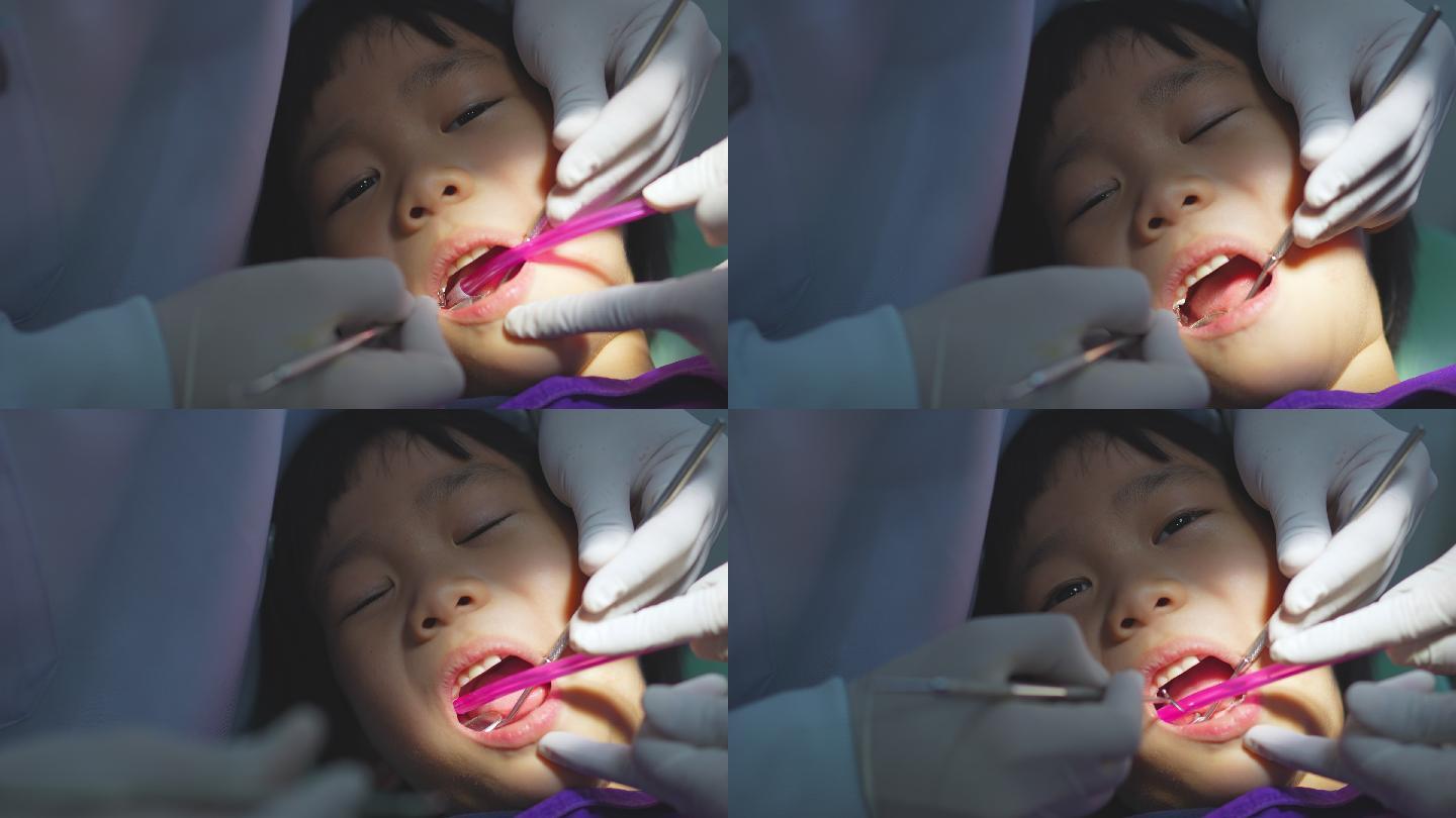 牙科医生的手正在牙科诊所为一名6岁的亚洲小孩做牙齿护理