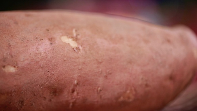 【镜头合集】食品安全发芽的红薯白薯