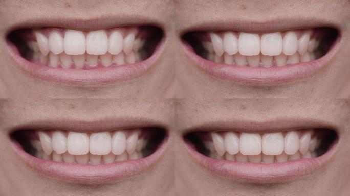 微笑洁白的牙齿嘴部牙科