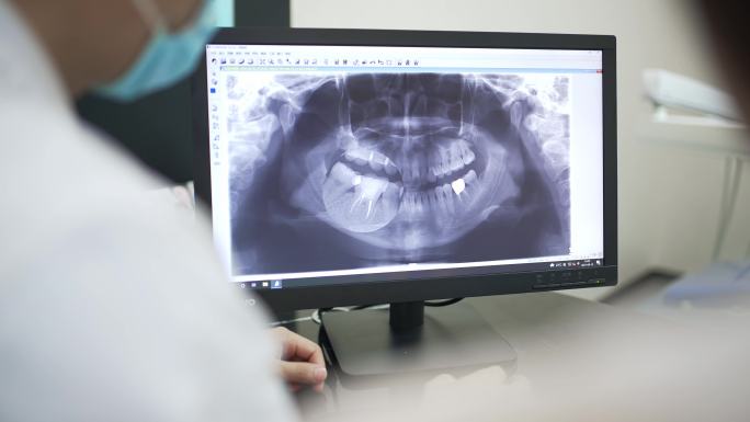 看x光片的牙医牙片ct核磁