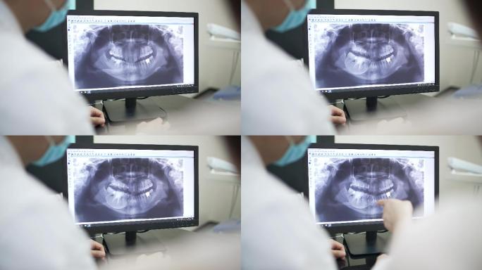 看x光片的牙医牙片ct核磁