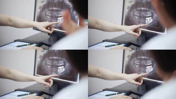 看x光片的牙医口腔拍片拔牙蛀齿