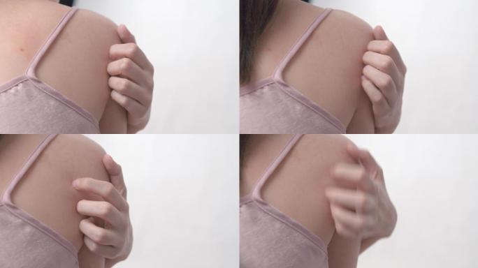 4k分辨率的亚洲女人用手抓他发痒的背部。医疗保健和医疗概念。皮肤湿疹