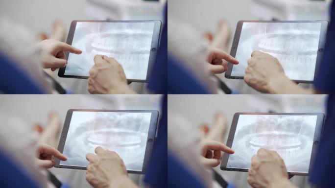 牙医在数字平板电脑上看x光片