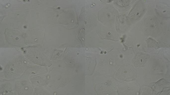 阴道拭子湿涂片显微镜下的生物