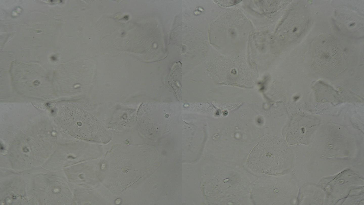 阴道拭子湿涂片显微镜下的生物