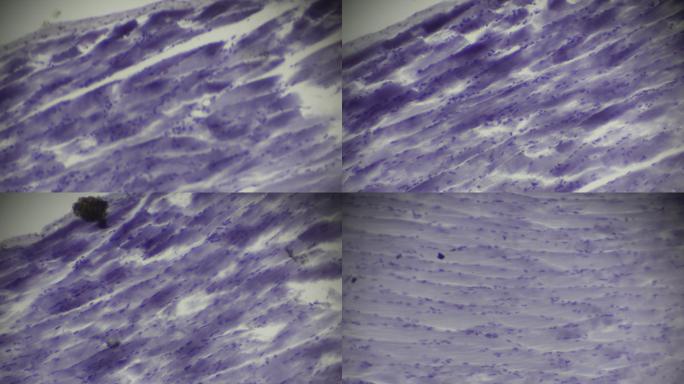 骨骼肌侧切面显微镜观察