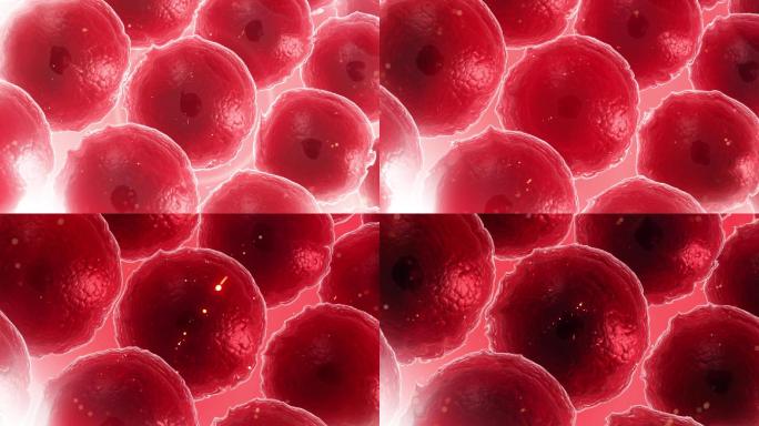 胰岛细胞坏死干瘪