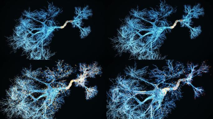 神经元系统全息图分叉