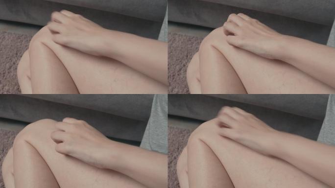 4k分辨率的亚洲美女坐在家里的沙发上，用手抓着发痒的皮肤腿。虫咬痛的。医疗保健概念。