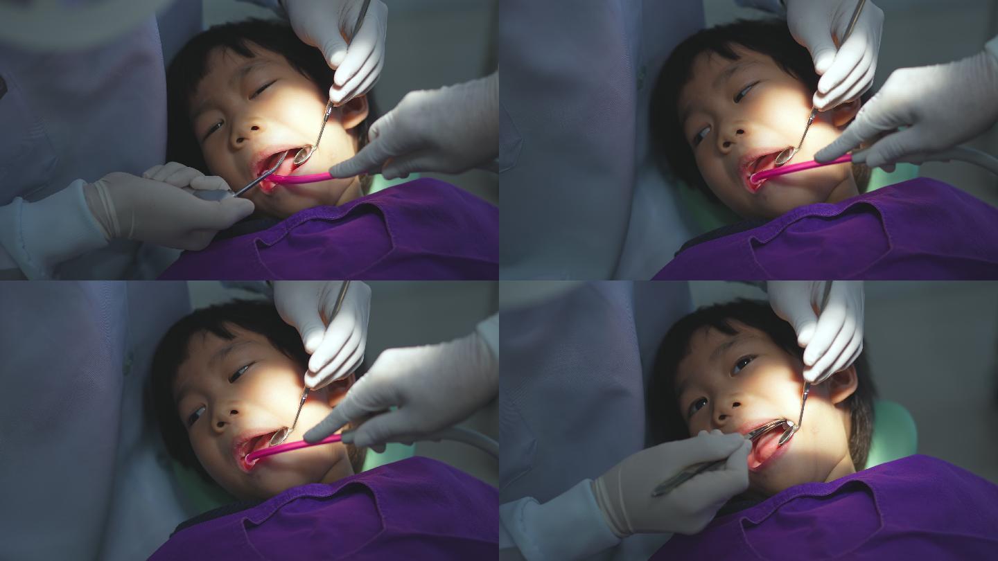 牙医医生的手正在牙科诊所为一名6岁亚洲小孩的牙齿进行治疗