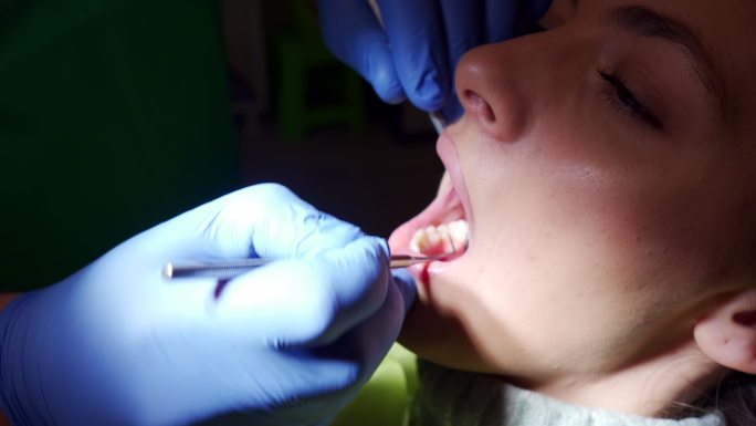 牙科医生检查女性患者的B卷