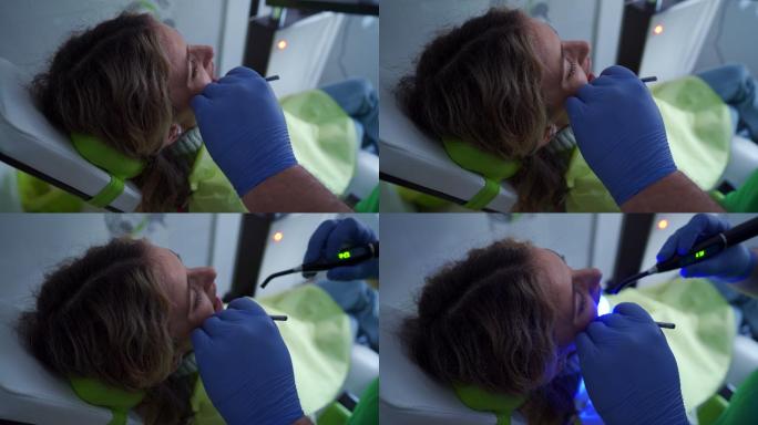 牙科医生用紫外线灯硬化牙齿填充物的B辊