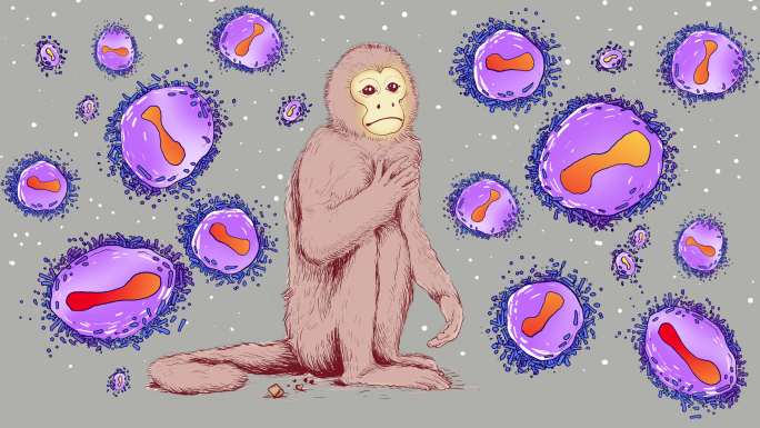 猴痘疫情传播风险
