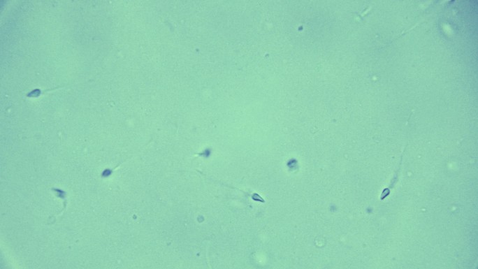 人类精子人类精子显微镜人类精子特写
