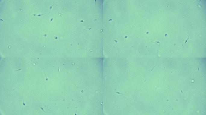 人类精子人类精子显微镜人类精子特写