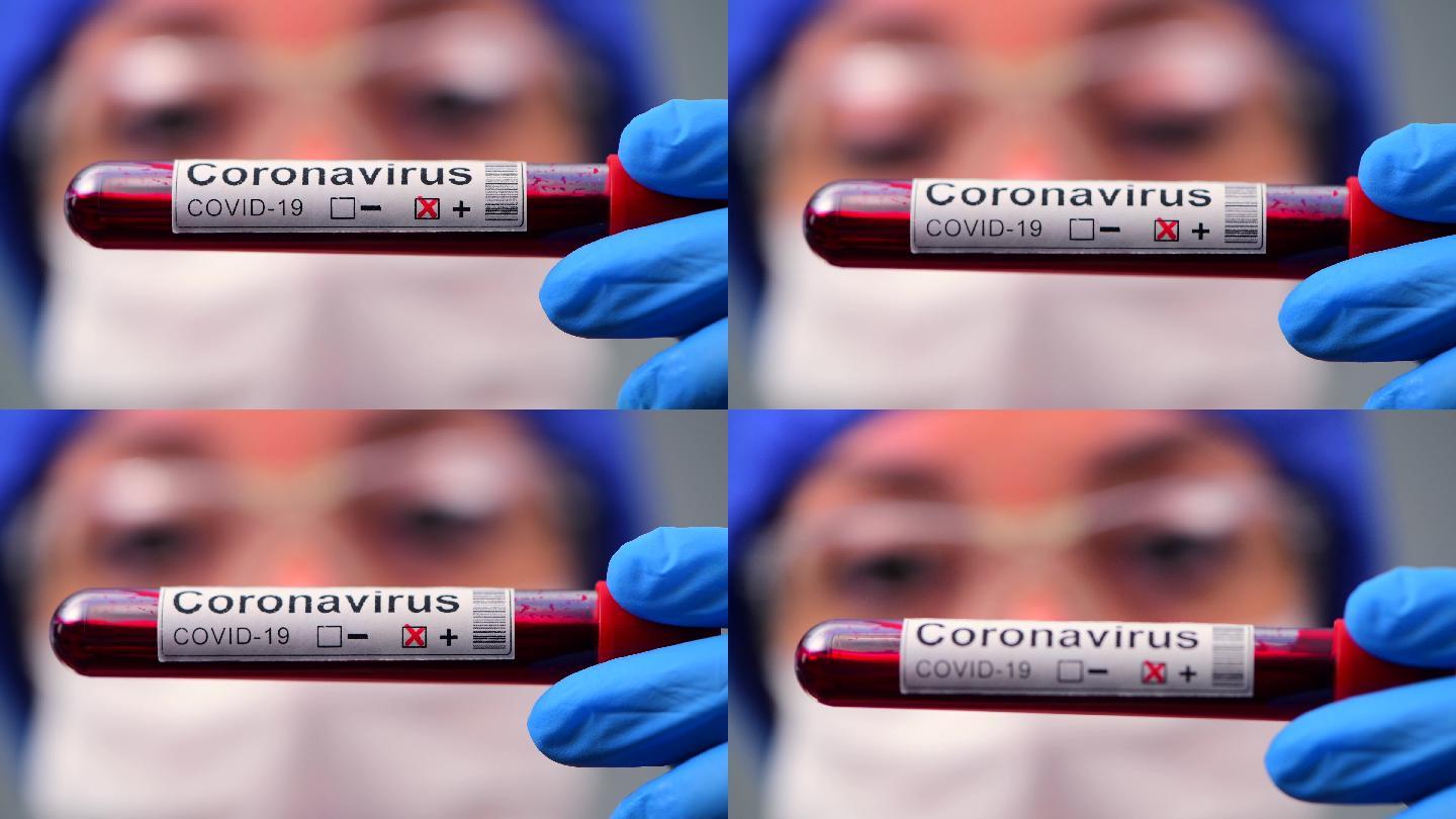 用试剂盒检测冠状病毒冠状病毒19型医学样品新的冠状病毒爆发
