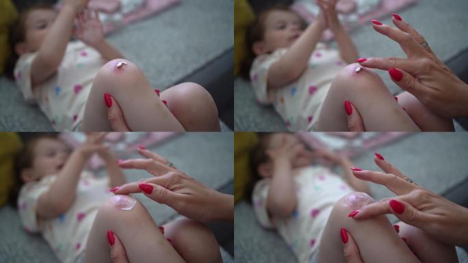 贴心的母亲将药膏涂抹在女儿擦伤的膝盖上，这样伤口就可以很容易愈合