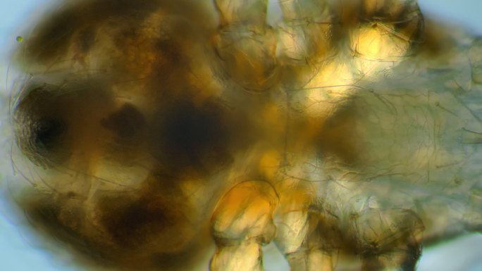 显微镜下的螨螨虫微距显微镜