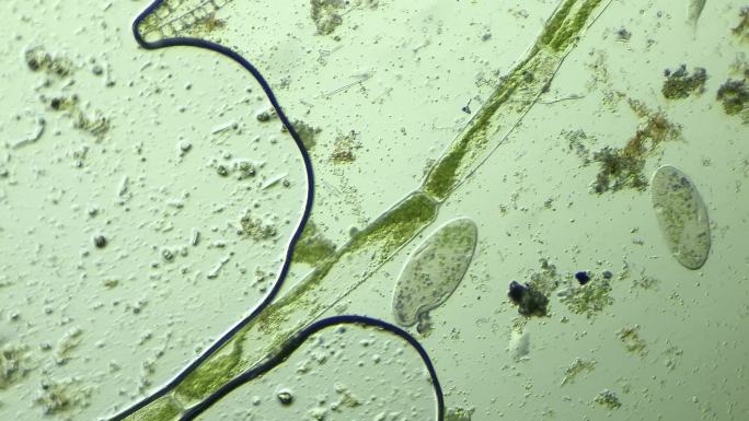 显微镜下的微观世界，草履虫8